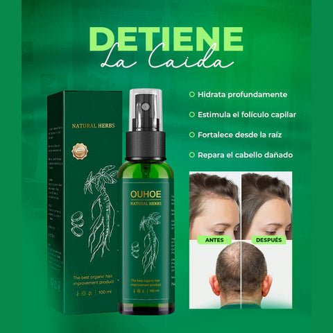 Image of OUHOE™️ - CRECIMIENTO CAPILAR Y CONTROL DE CAIDA